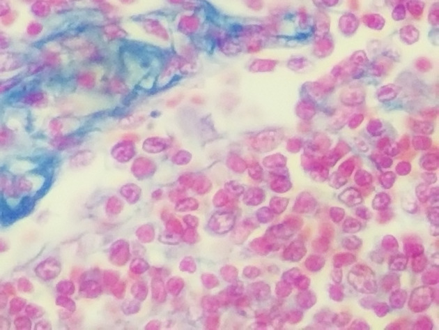 Reticular Connective Slides - Reticular Connective 02 400X